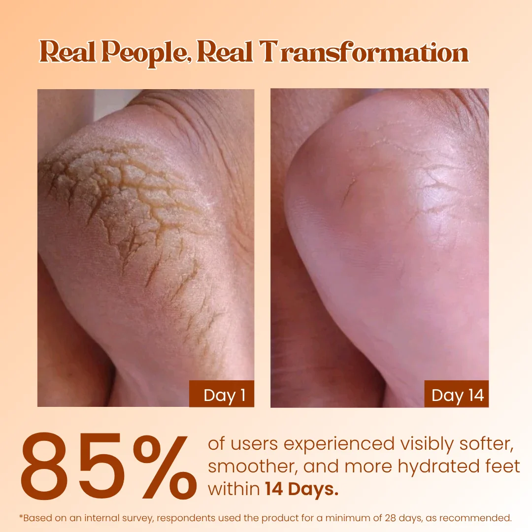 Pokonut Foot Care Combo - Image 8