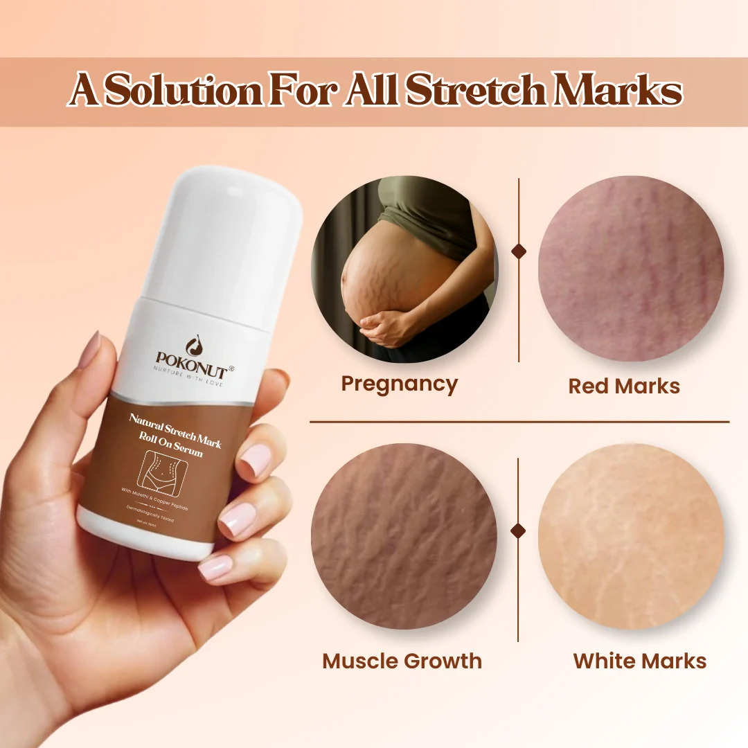 Stretch Mark Repair Combo – Day and Night Care for Visible Results - Image 4