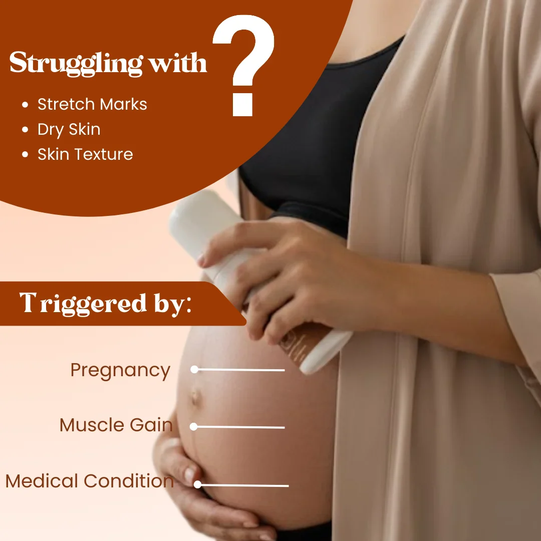 Stretch Mark Roll On - Image 3